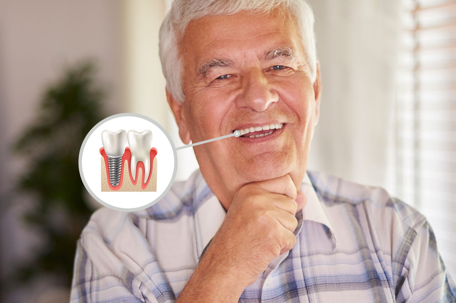 dentista-implante-dentário-em-são-joão-del-rei-mg